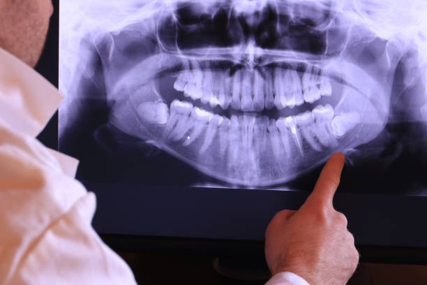 Best Knocked-Out Tooth Emergency  in Benton Heights, MI