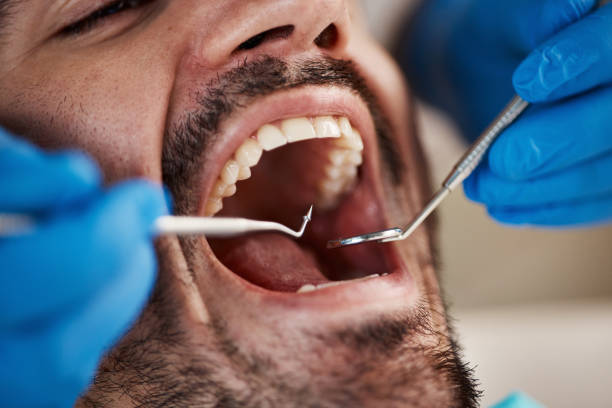 Best Root Canal Emergency Dentist  in Benton Heights, MI